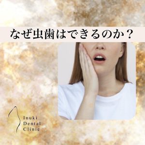 177『歯を残す』と『歯を治す』ことの違い