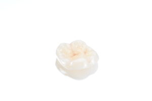 当院での被せ物や詰め物治療について