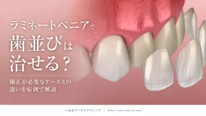 ラミネートベニアで歯並びは治せる？矯正が必要なケースとの違いを症例で解説