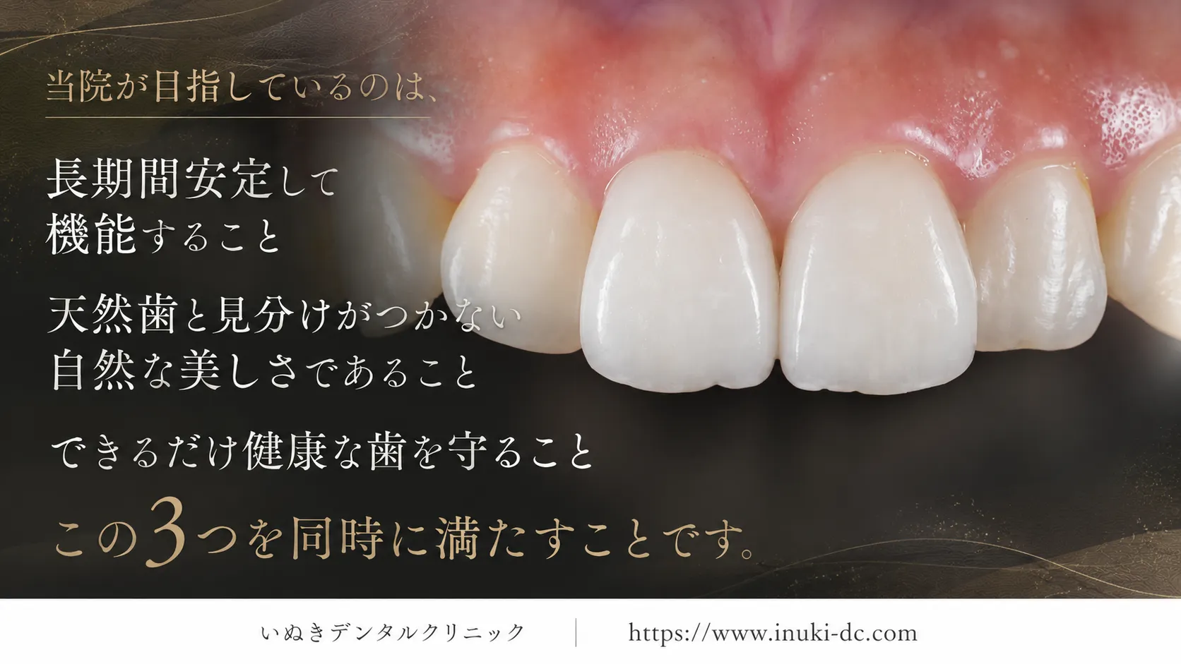 当院が目指しているのは、「外れないラミネートベニア」ではありません
