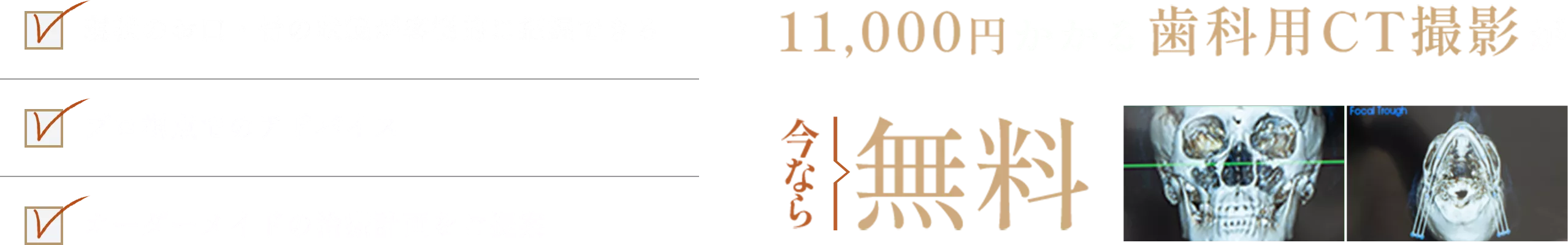 インプラント個別無料相談