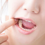 奥歯インプラントが難しい理由やメリット・デメリット、リスクについて