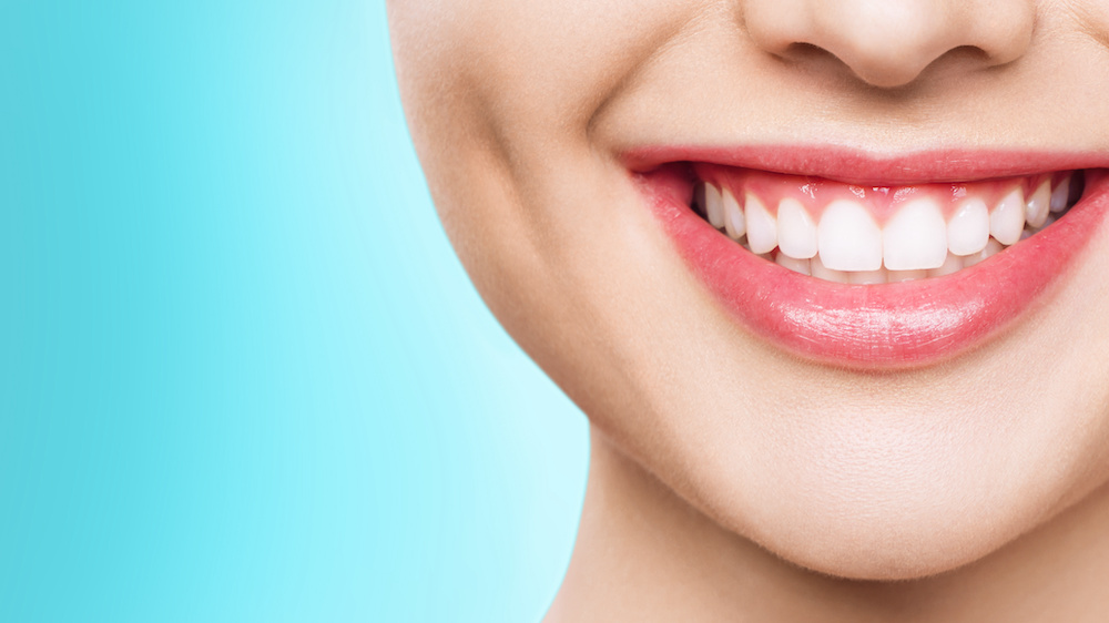 セラミック矯正のメリット｜手軽に審美性の高い歯を実現できる