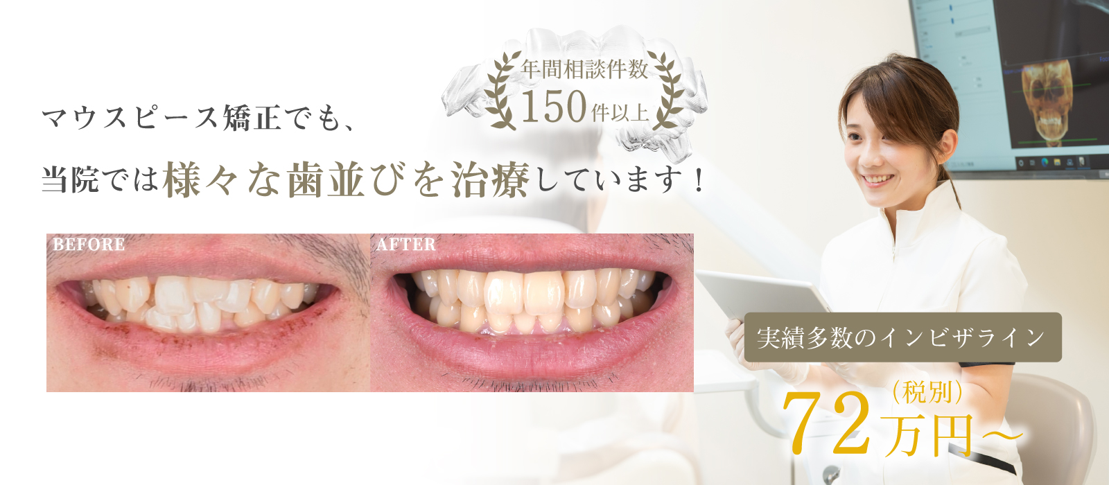 明石でインビザライン（マウスピース矯正）